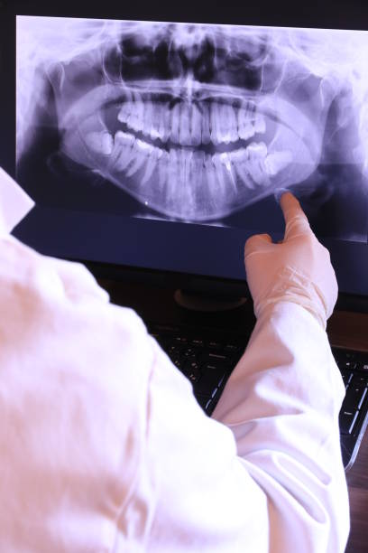 Best Emergency Dental Care for Broken or Chipped Teeth in Alhambra, CA