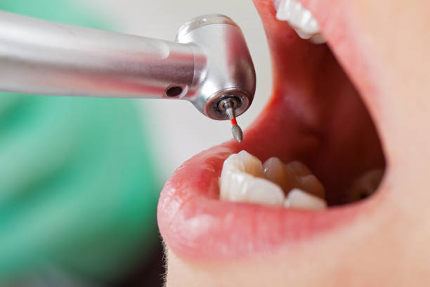Best After-Hours Dental Trauma Care in Alhambra, CA